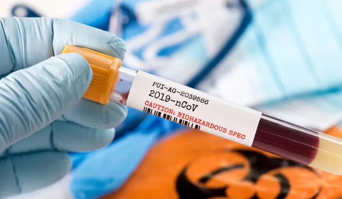 16.558 osoba u svijetu umrlo zbog korone