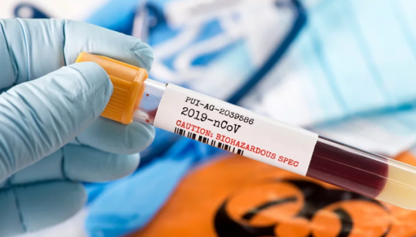 16.558 osoba u svijetu umrlo zbog korone