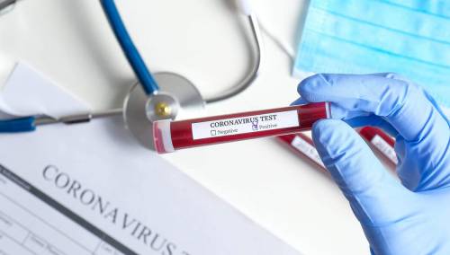 20 pozitivnih na koronavirus, od toga 16 iz Sarajeva, četvero iz Travnika