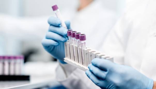 32 nova slučaja zaraze koronavirusom u KS-u