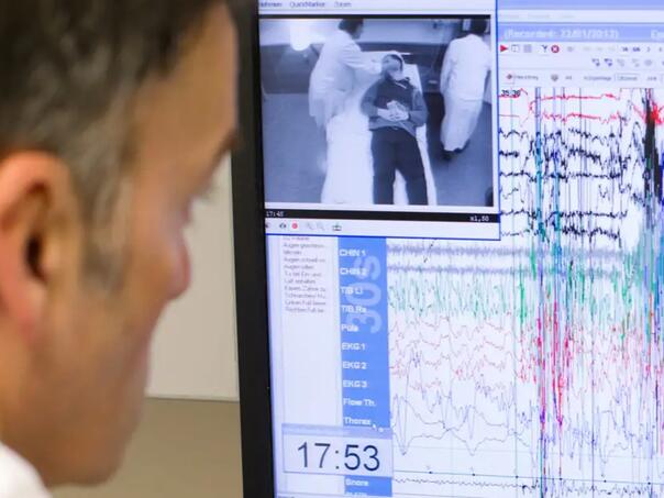 AI već nakon jedne noći sna prepoznaje rizik od više od 130 bolesti