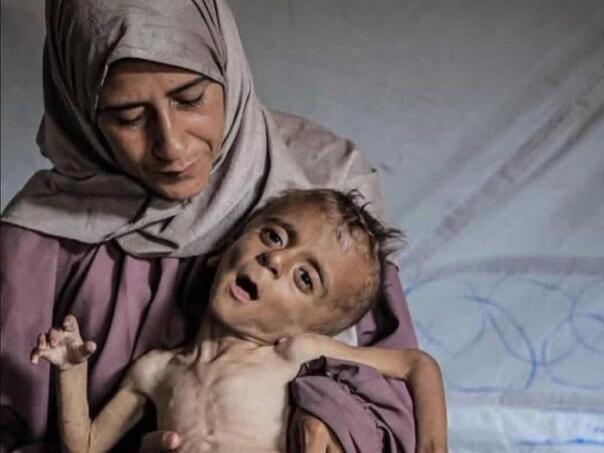 Alarmantan izvještaj UN-a: U Gazi se dešava najgori mogući scenarij