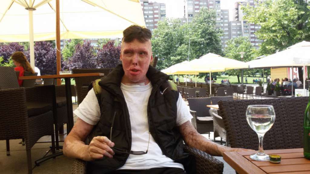 Aldin Jacić ponovo mora na operativni zahvat