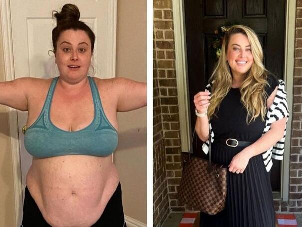 Amerikanka nakon uvreda smršala više od 60 kilograma, zvali je 'nasukani kit'