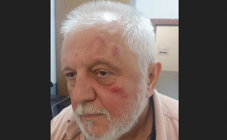 Antonijević nakon incidenta s Bjelogrlićem: Prišao mi je sleđa, nisam uspio da se branim