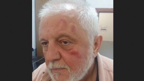 Antonijević nakon incidenta s Bjelogrlićem: Prišao mi je sleđa, nisam uspio da se branim