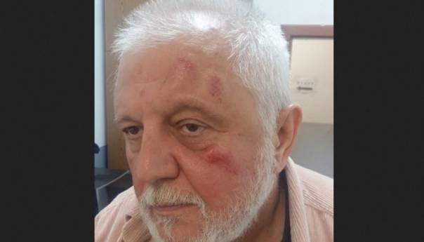 Antonijević nakon incidenta s Bjelogrlićem: Prišao mi je sleđa, nisam uspio da se branim