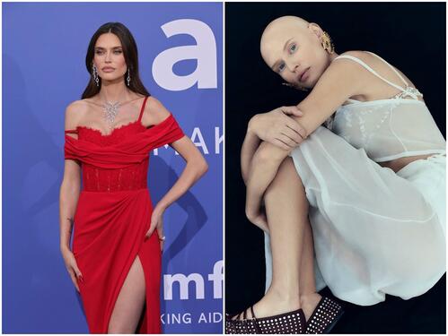 Bianca Balti nakon borbe sa kancerom pokazala snagu novog izgleda