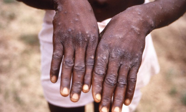 Bidenova administracija proglasila majmunske boginje vanrednom situacijom