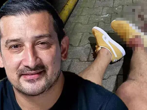 Bivši reprezentativac Turske zbog komentara ranjen u nogu