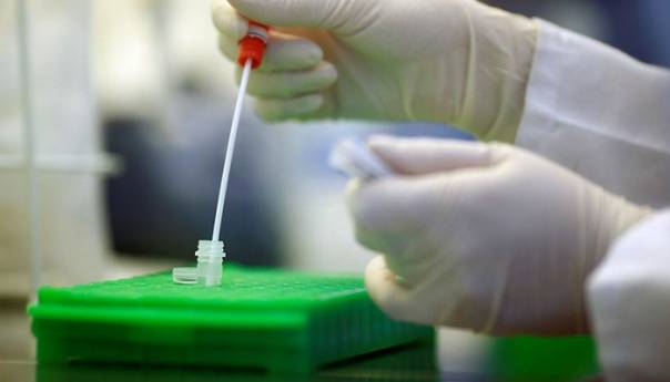 Bloomberg: Zaraženi prenosi virus na skoro 6 ljudi