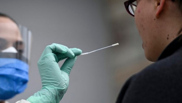 Bolnica u Izraelu testira brži, precizniji i jeftiniji test na koronavirus