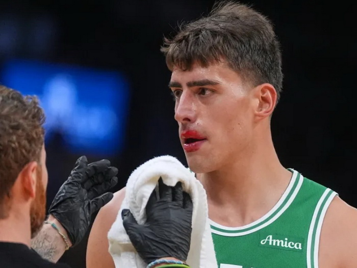 Boston objavio loše vijesti, Garzu očekuje pauza