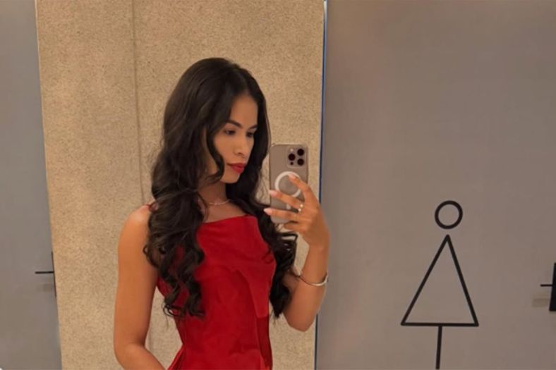 Brazilska manekenka preminula osam dana nakon operacije