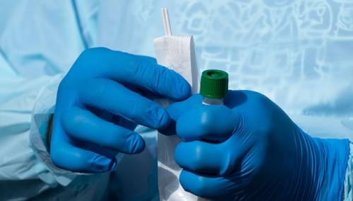 Broj zaraženih u Srbiji porastao na 659, još dvoje preminulo