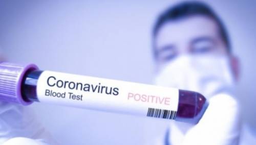 Broj zaraženih u Srbiji porastao na 97