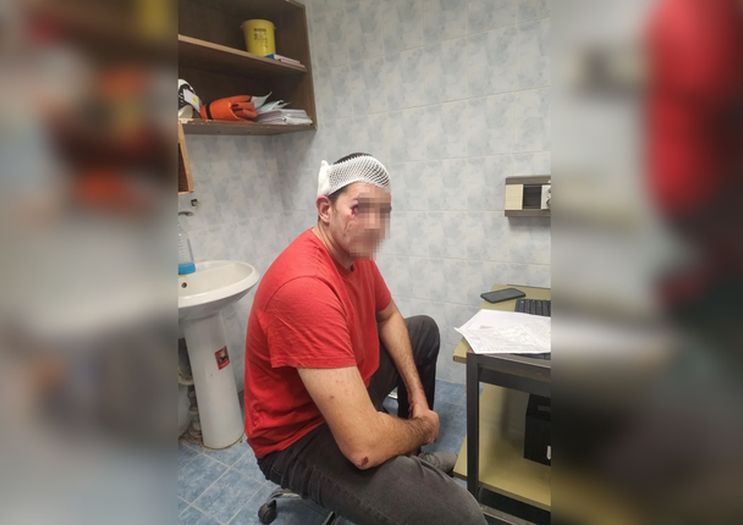 Brutalno pretučen posmatrač izbora u Beogradu
