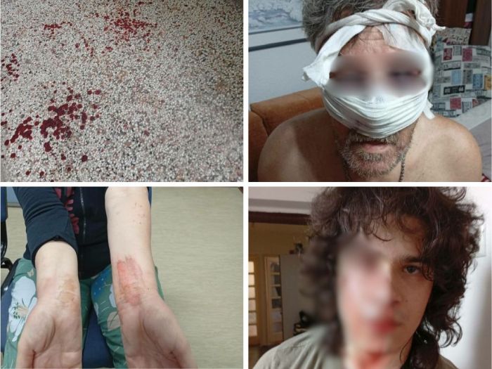 Brutalno pretučena porodica u Tuzli: U toku istraga, jedna osoba uhapšena