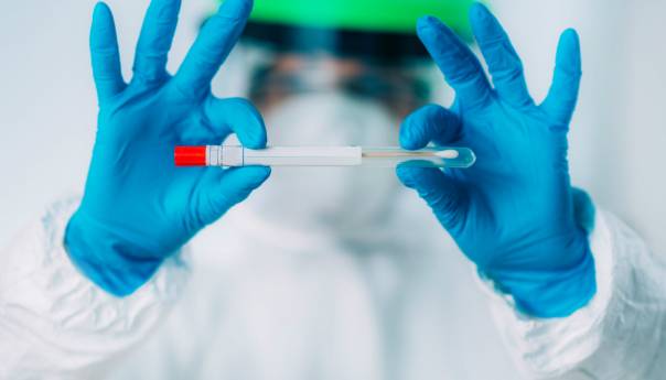 Cijena PCR testova u BiH od sada je znatno niža