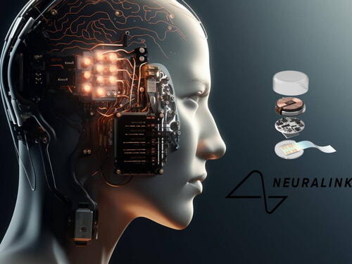 Čip ugrađen u mozak i trećem pacijentu