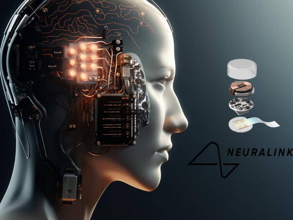 Čip ugrađen u mozak i trećem pacijentu