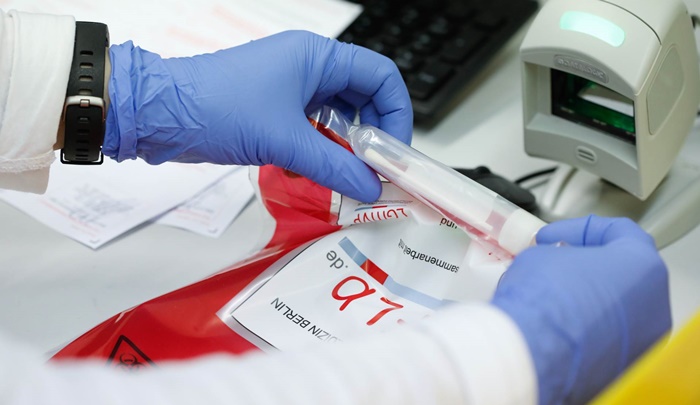 Crna Gora: Četiri pacijenta na intenzivnoj, jedan životno ugrožen