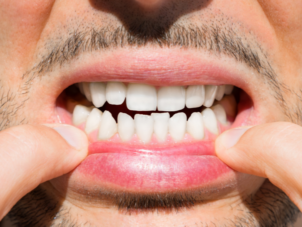 Da li brinete o svom zdravlju: Pet stvari ne bi trebalo da ignorišete