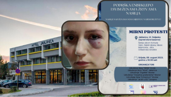 Danas mirni protest u znak podrške pretučenoj radnici iz Jablanice