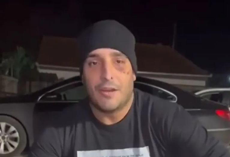 Darko Lazić doživio novu nesreću: Pao sa kvada i slomio rebro