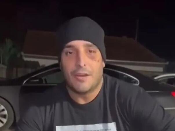 Darko Lazić doživio novu nesreću: Pao sa kvada i slomio rebro