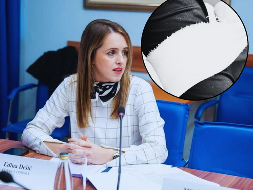 Dešić: Hoće li Turci u Crnoj Gori morati nositi trake na rukavima!?