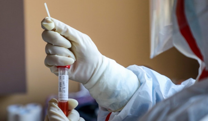 Djeca OŠ "Grbavica II" se vratila iz Milana: Imaju povišenu temperaturu