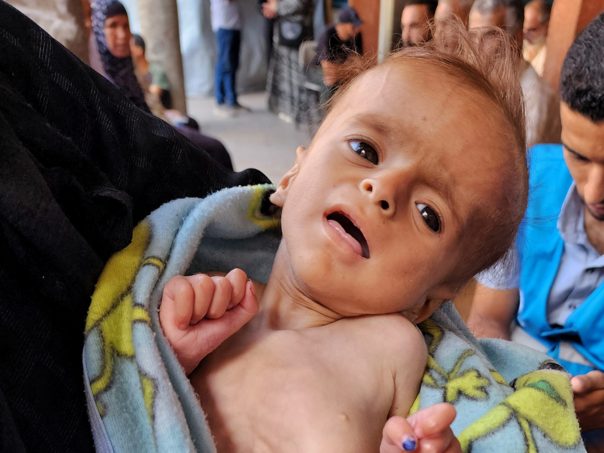 Djeca u Gazi umiru gladna: "Volio bih biti u raju kod svoje majke, tamo ima ljubavi, hrane i vode"