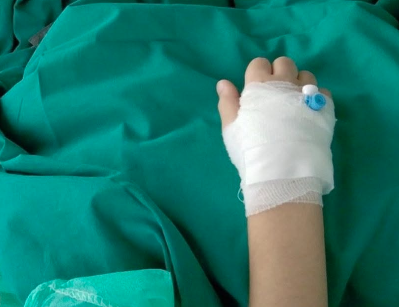 Dječaku (9) iz Sarajeva hitno potrebno 70.000 eura za operaciju tumora