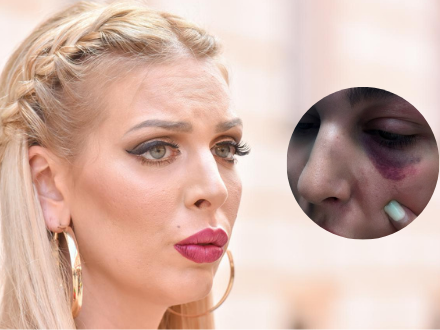 Ava Karabatić prijavila partnera za nasilje, pa završila u policiji