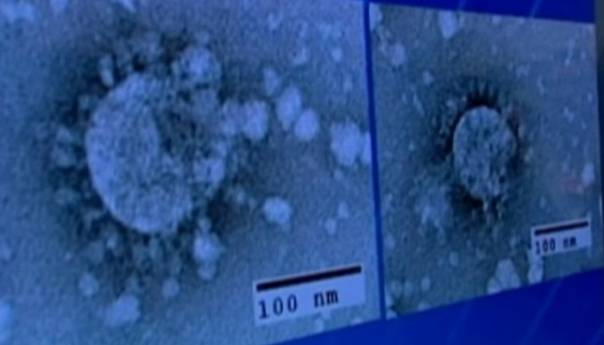 Potvrđen drugi slučaj koronavirusa u Americi