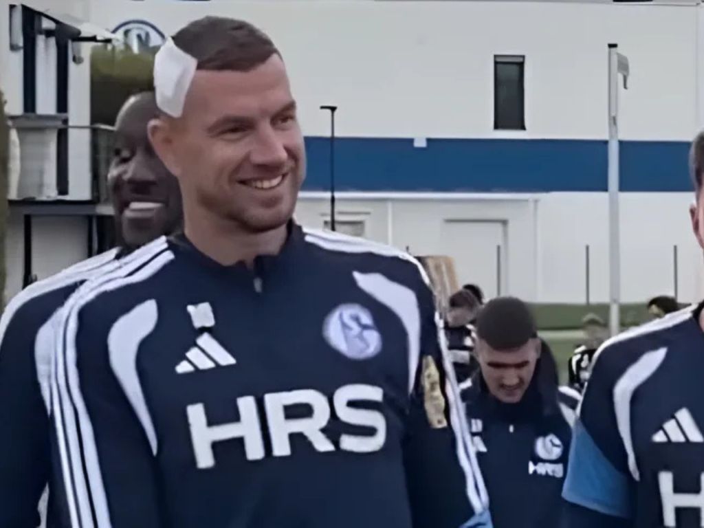 Džeko se pojavio na treningu s flasterom na glavi, Muslić ima dobre i loše vijesti