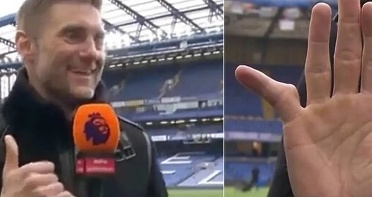 Englezi šokirani izgledom malog prsta bivšeg golmana nakon 20-godišnje karijere