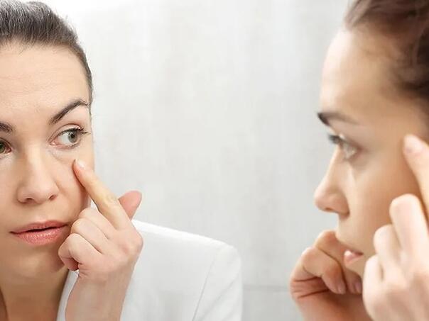 Faktori koji uzrokuju podočnjake