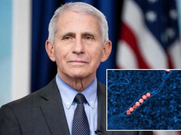 Fauci zaražen virusom Zapadnog Nila