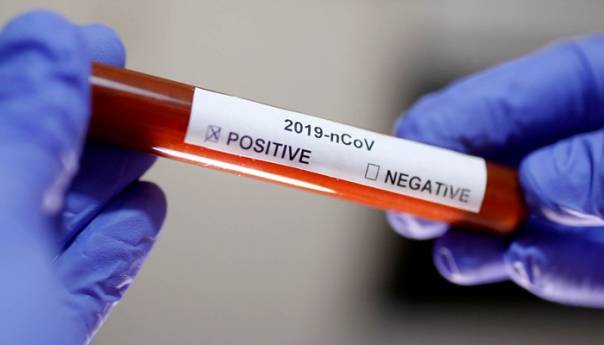 Francuska: Broj preminulih zbog zaraze korona virusom povećan na dva