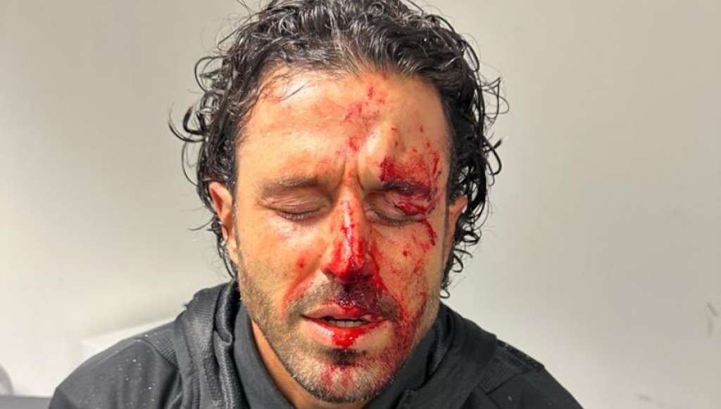 Francuska vlada osuđuje 'odvratno' nasilje navijača Marseillea