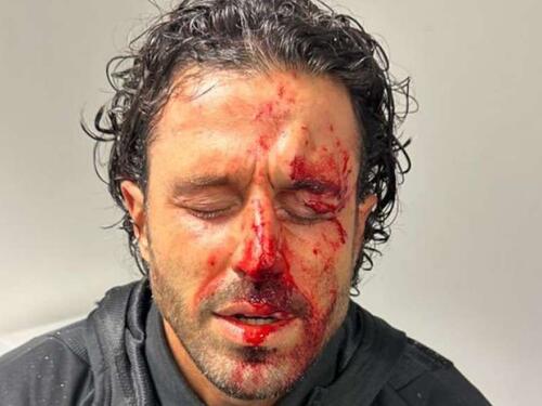 Francuska vlada osuđuje 'odvratno' nasilje navijača Marseillea