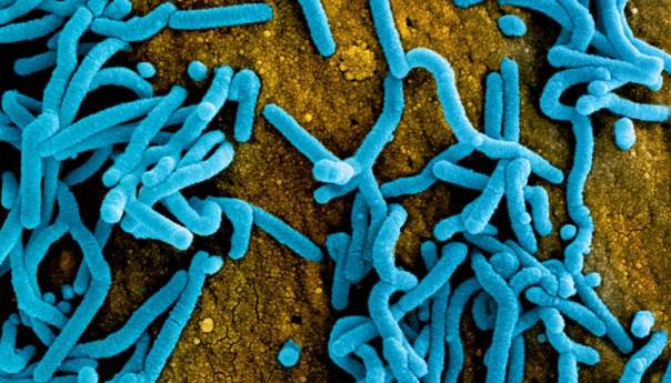 Gana potvrdila prve smrtne slučajeve od opasnog Marburg virusa