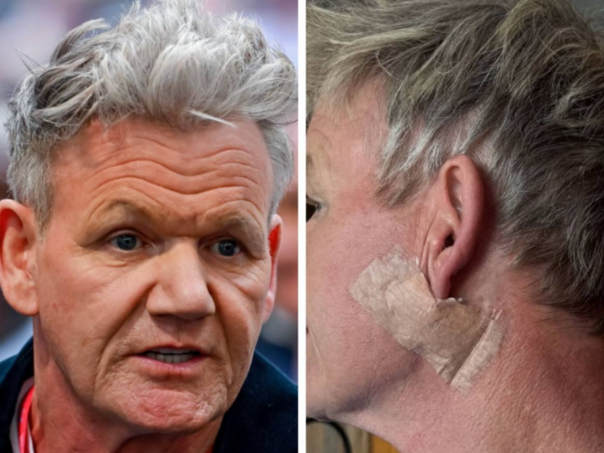 Gordon Ramsay nakon operacije: "Uklonili su mi karcinom"