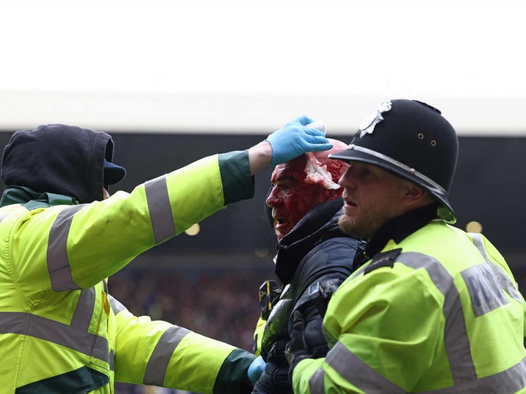 Haos u Engleskoj: Krvave glave, spašavanje djeteta i prekid utakmice