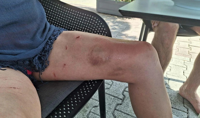 Hitna iz Baške Vode nije nam htjela ni očistiti rane, jer sve to prvo moramo platiti...