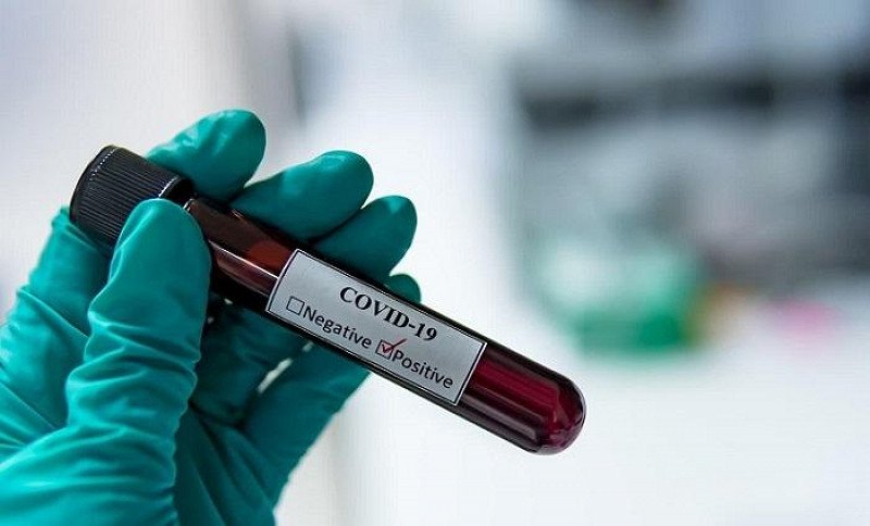 HNK: Još dva slučaja zaraze, po jedan u Čitluku i Jablanici