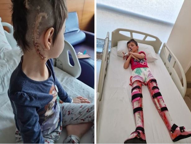 Hrabroj Medini treba 32. operacija mozga: Pomozimo joj zajedno!