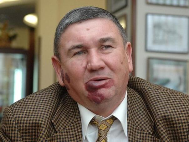 Hrvatski branitelj privatno tužio Srbiju pa mu se pridružilo još 650 logoraša